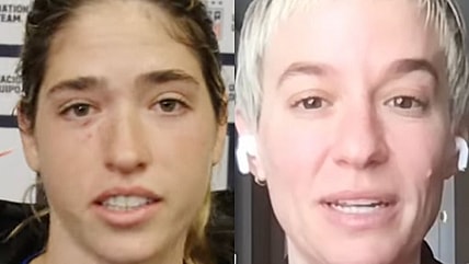 Korbin Albert Megan Rapinoe